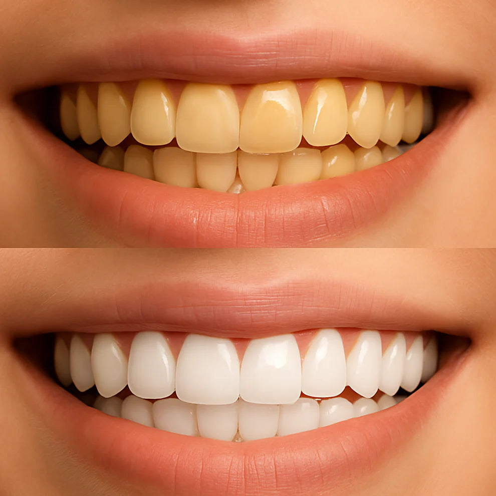 Bandes Blanchissantes